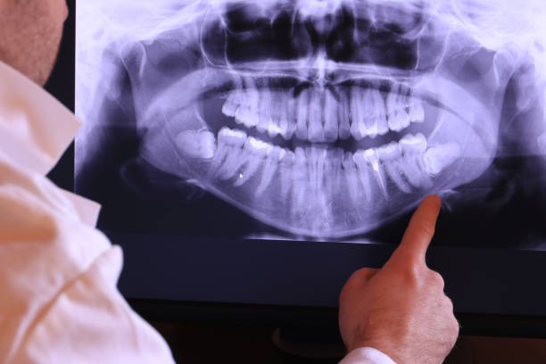 Best Emergency Care for Gum Disease in Doolittle, TX