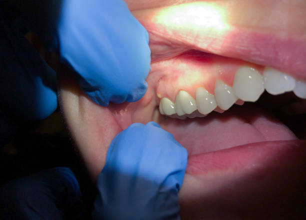 Best Emergency Cosmetic Dentistry (e.g., broken veneers) in Doolittle, TX